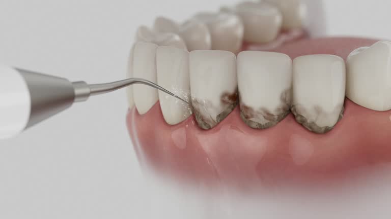 Reliable Dental contractor in Larch Way, WA by Dentist Open Now
